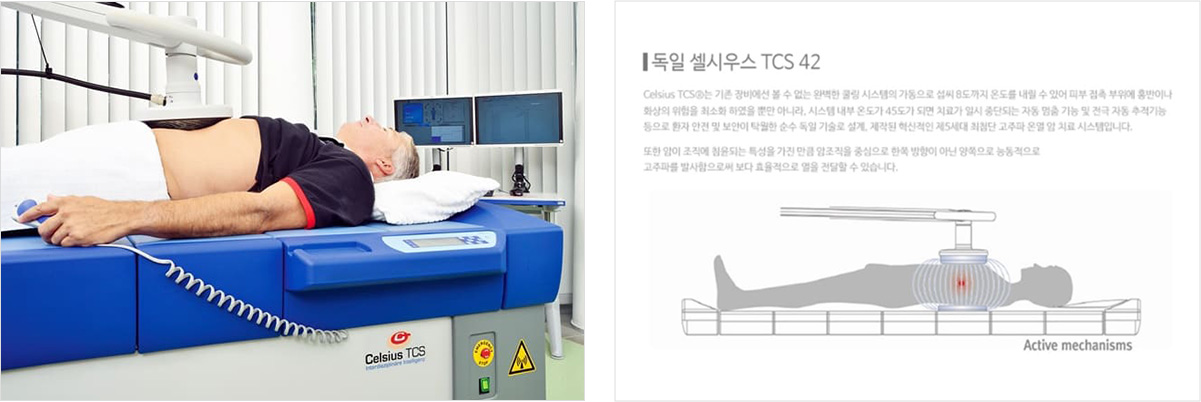 독일 셀시우스